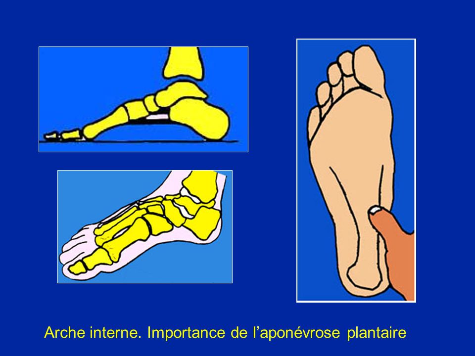 G n ralit s Anatomie Rappel Examen du pied Pied plat Pied creux